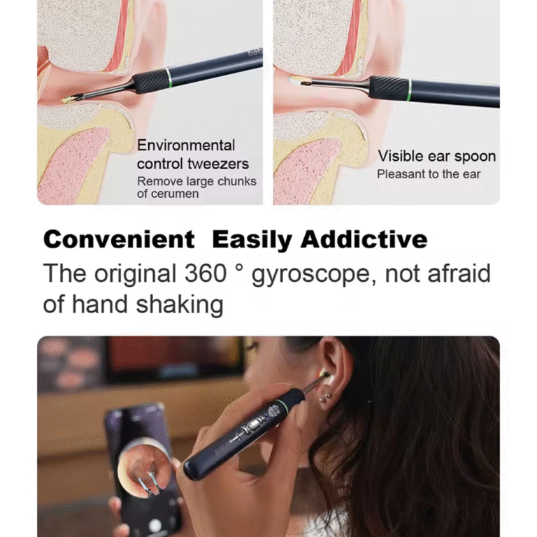 گوش پاک کن هوشمند شیائومی مدل Xiaomi Bebird note 5