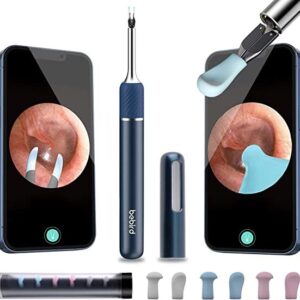 گوش پاک کن هوشمند شیائومی مدل Xiaomi Bebird note 5